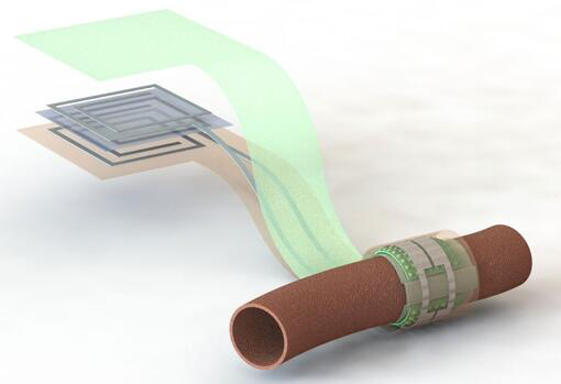 上圖描繪了這款可生物降解的壓力傳感器，它圍繞著一根血管，天線在左側(分離的層狀結構，展示了天線結構的細節)